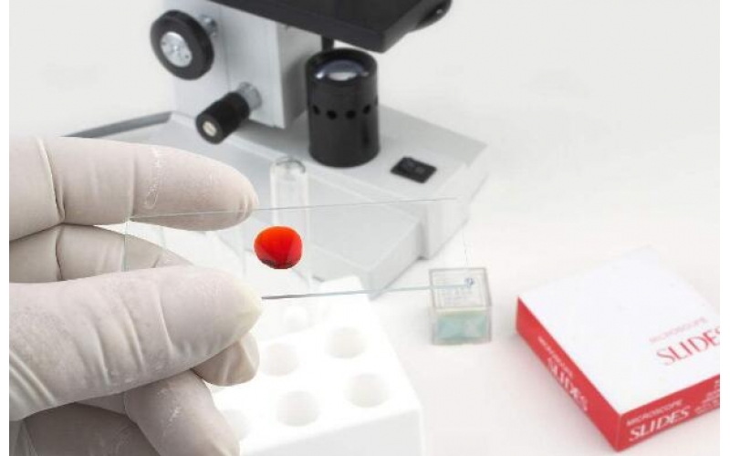 冬季空氣濕度也會影響甲醛檢測人體的健康